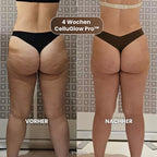 Anti-cellulite massageapparaat